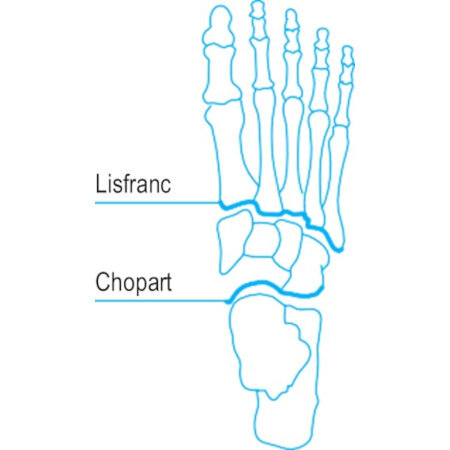 Bota Soft 2 Chopart/Lisfranc - korte kous na Chopart of Lisfranc amputatie - zwart - hoog katoengehalte - betekenis